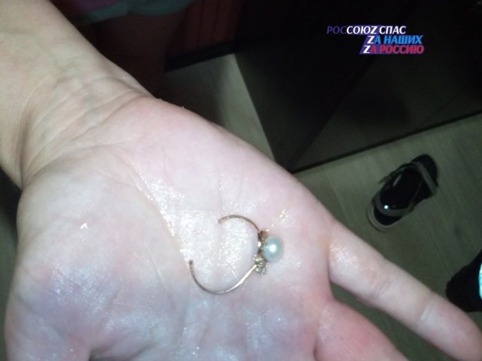 Спасатели сняли кольцо с пальца пострадавшей